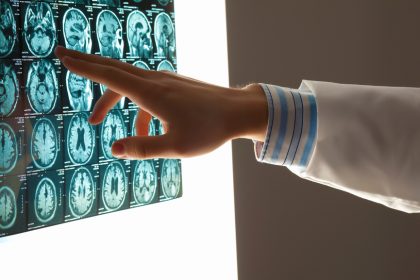 brain scan consultation